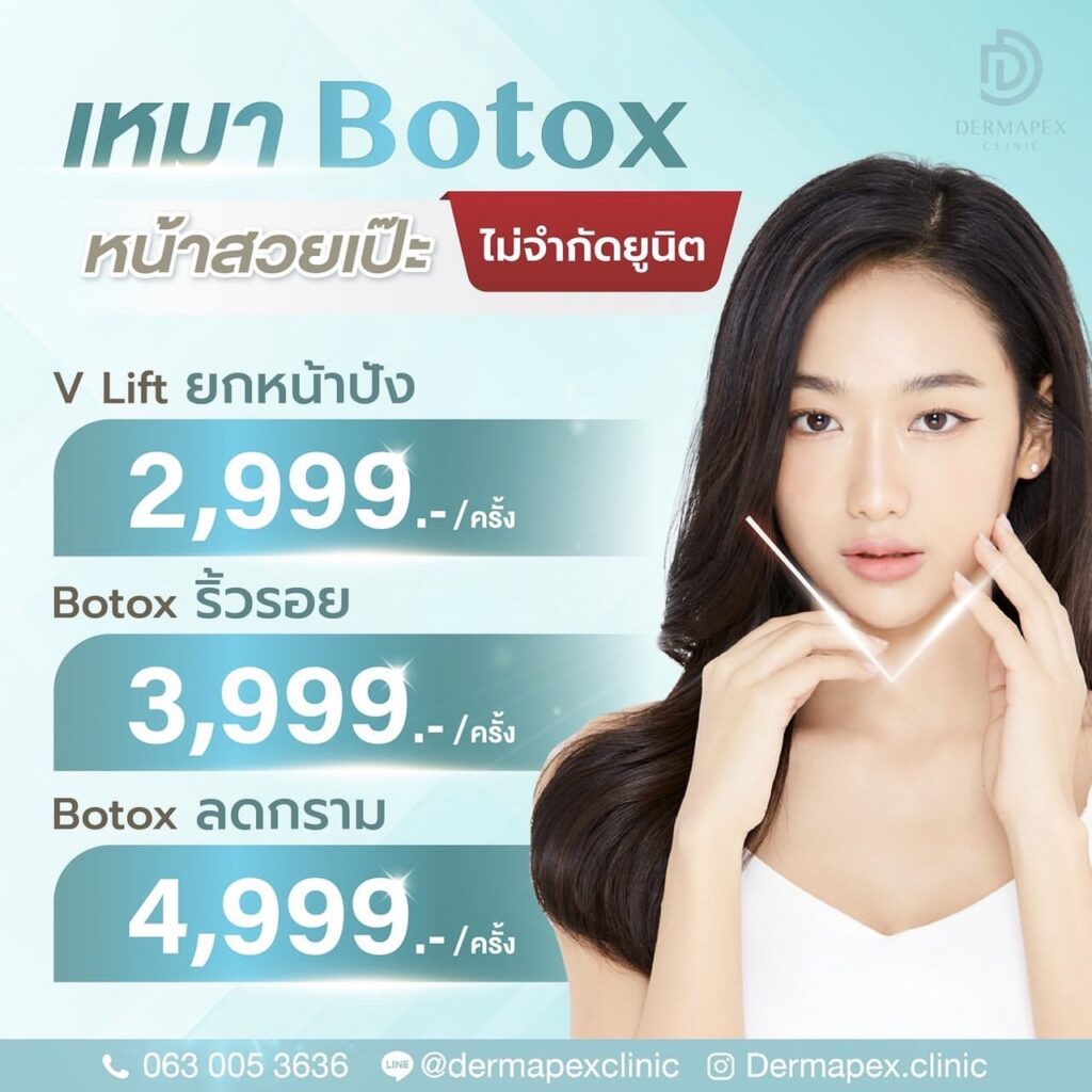 เหมา Botox